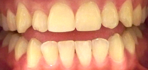 Dentist Near Cornelius NC 