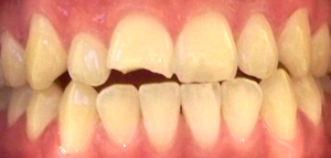 Cosmetic Dentist Cornelius NC