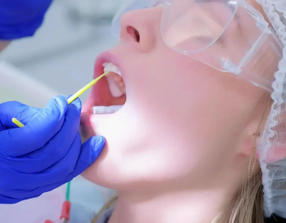 Dental Veneers Implant