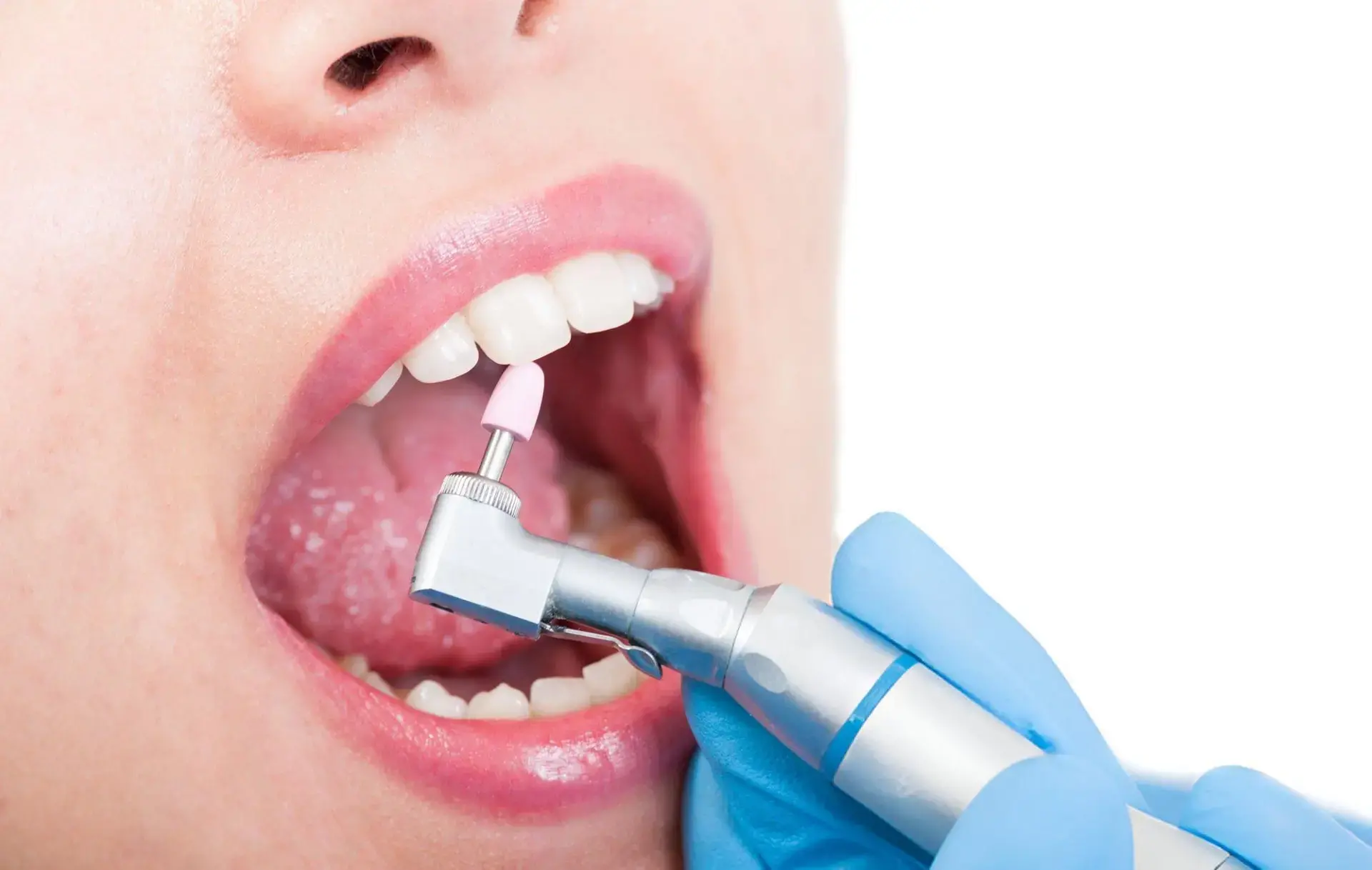 Denture Implant Treatment