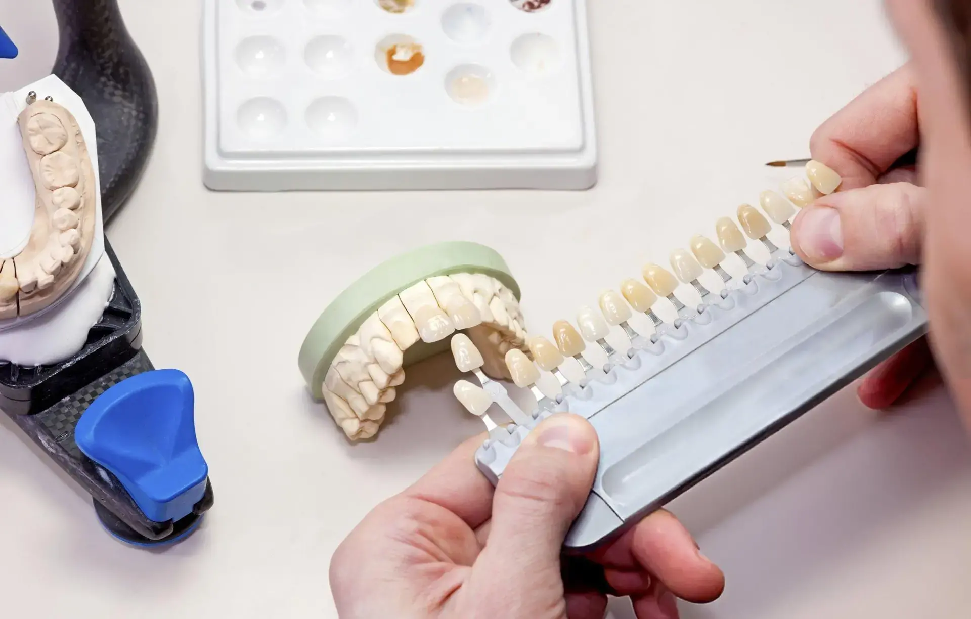 Dental Veneers Implant