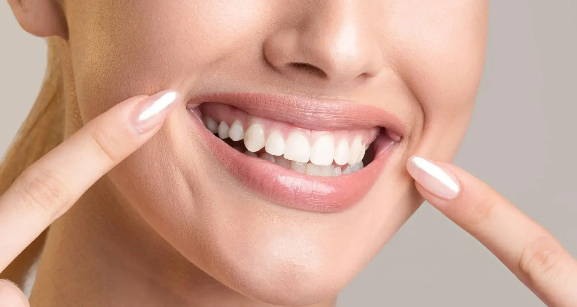 Smile Makeover Treatment Service