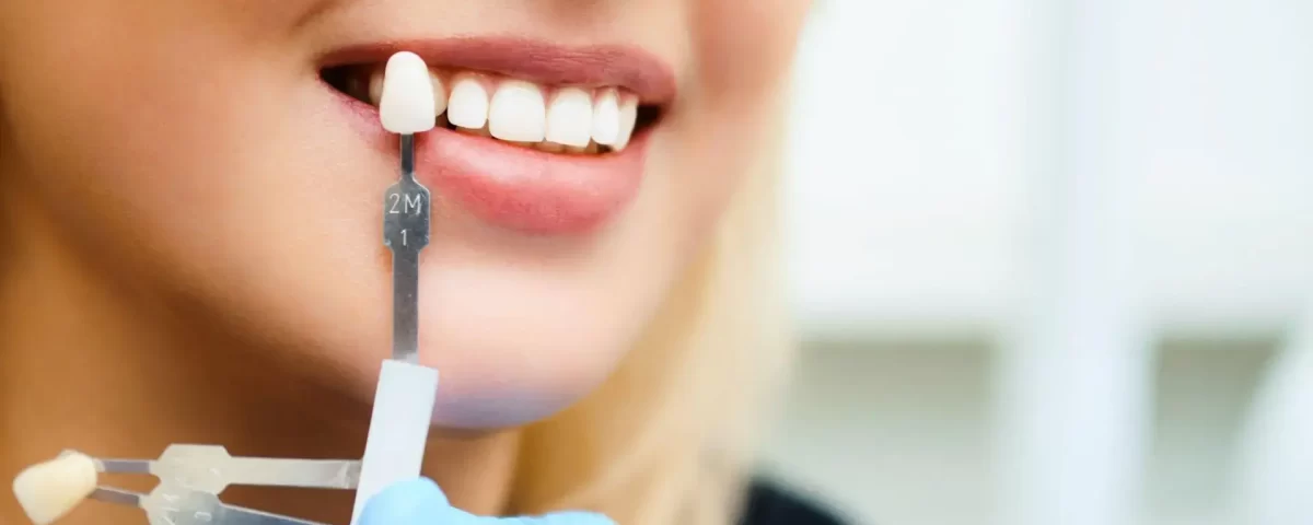 Advanced Cosmetic Dental Treatment