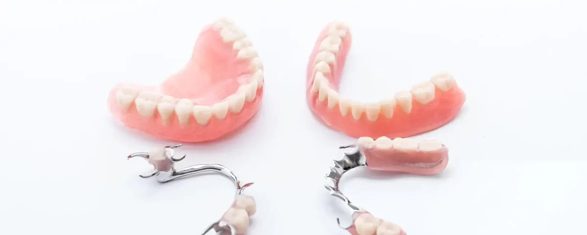 Price for Full Dental Implants