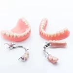 Price for Full Dental Implants