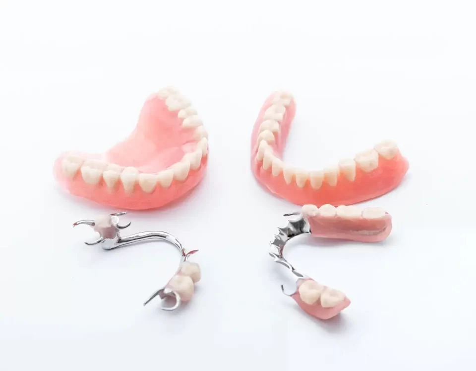 Price for Full Dental Implants