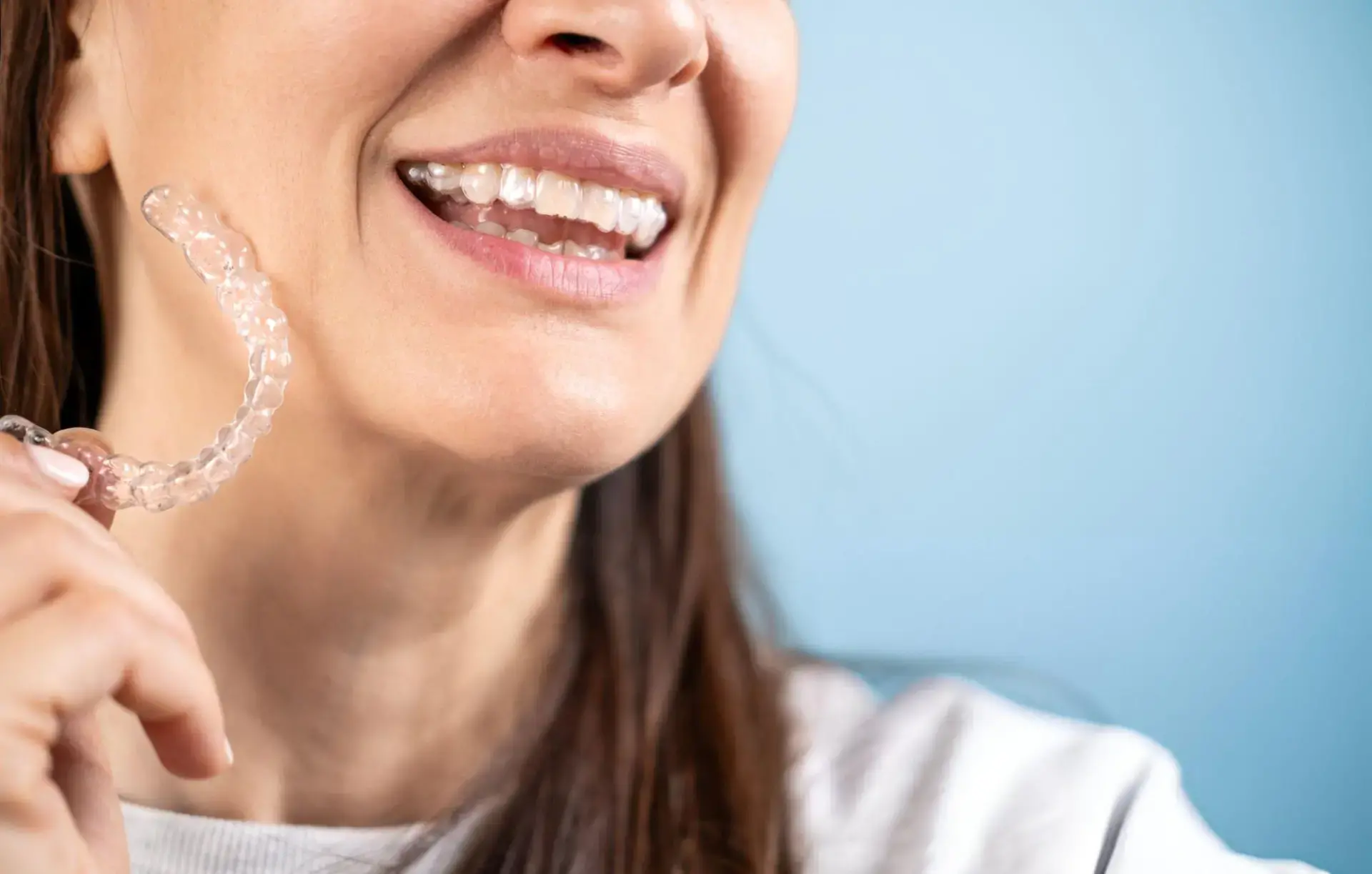 Invisalign Implant Service Provider