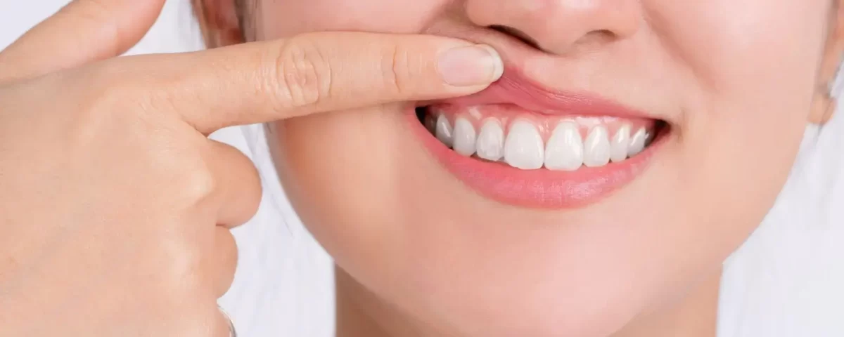 Periodontist Treatment Specialist