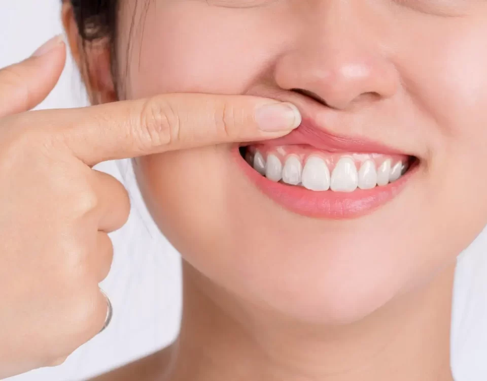 Periodontist Treatment Specialist