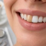 Skotzko Family Dental Clinic | Urgent: Signs of Tooth Infection You Need to Know in 2026 Skotzko Family Dental Clinic | Urgent: Signs of Tooth Infection You Need to Know in 2026
