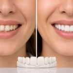 Skotzko Family Dental Clinic | Cosmetic Dentistry Near Me: A Cornelius, NC Smile Guide Skotzko Family Dental Clinic | Cosmetic Dentistry Near Me: A Cornelius, NC Smile Guide