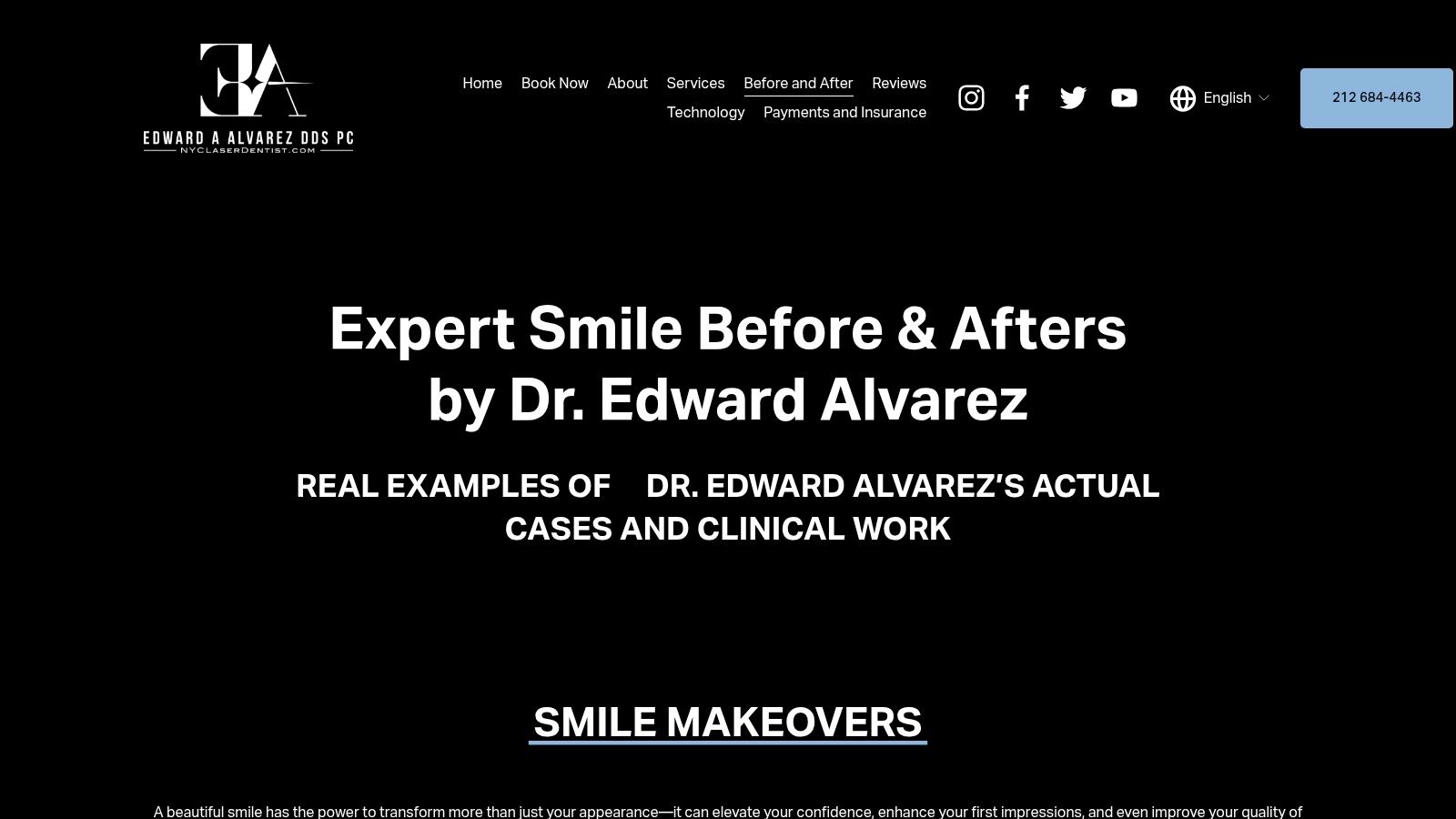Skotzko Family Dental Clinic | Veneers Before and After: 7 Smile Stories from Cornelius, NC Case 6: Replacing Old, Discolored Dental Bonding